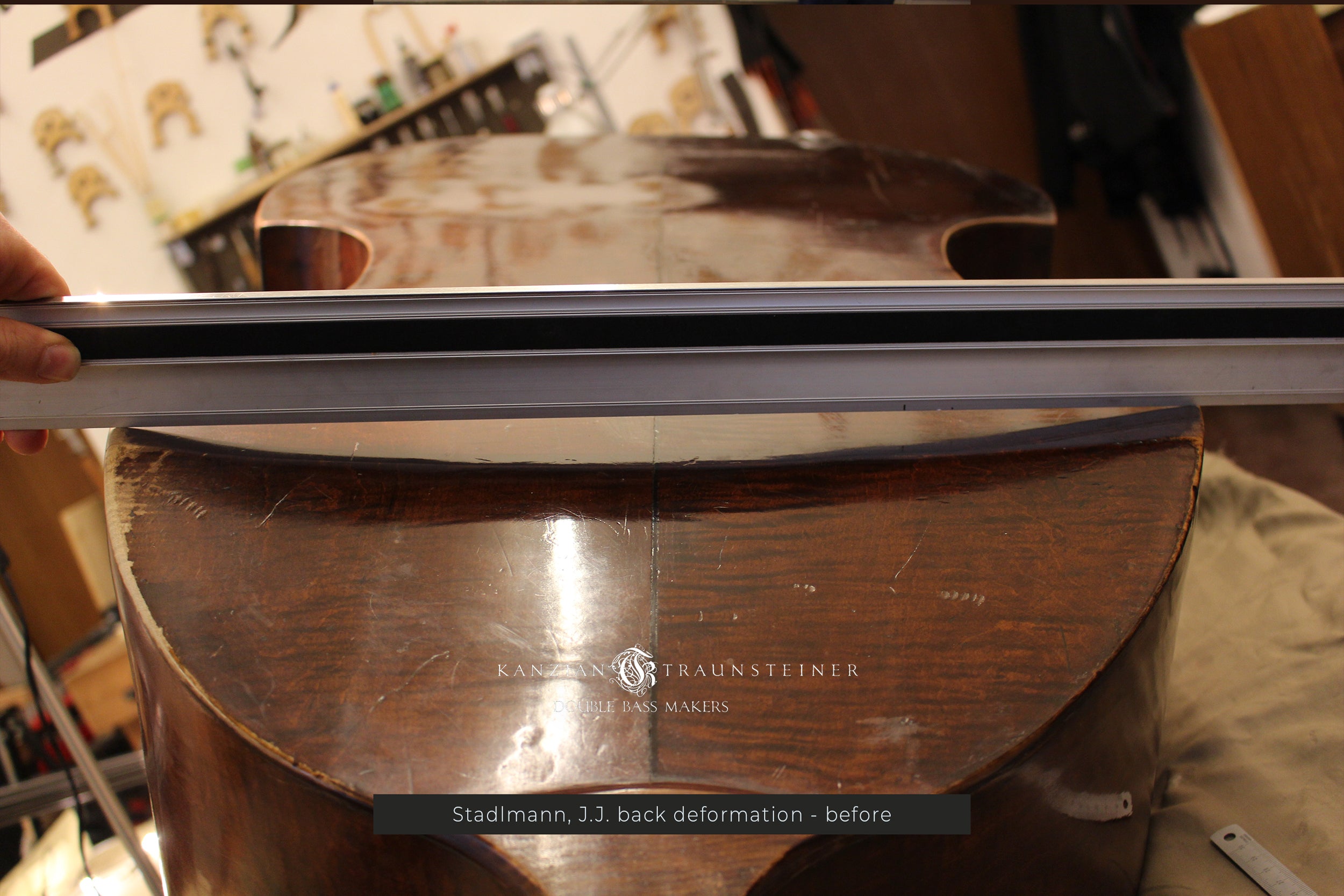 JJ Stadlman back deformation before K&T restoration