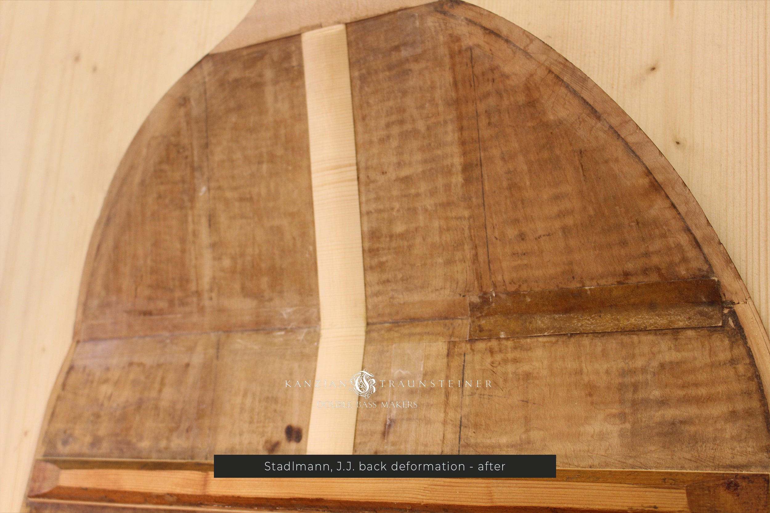 JJ Stadlman back deformation after K&T restoration