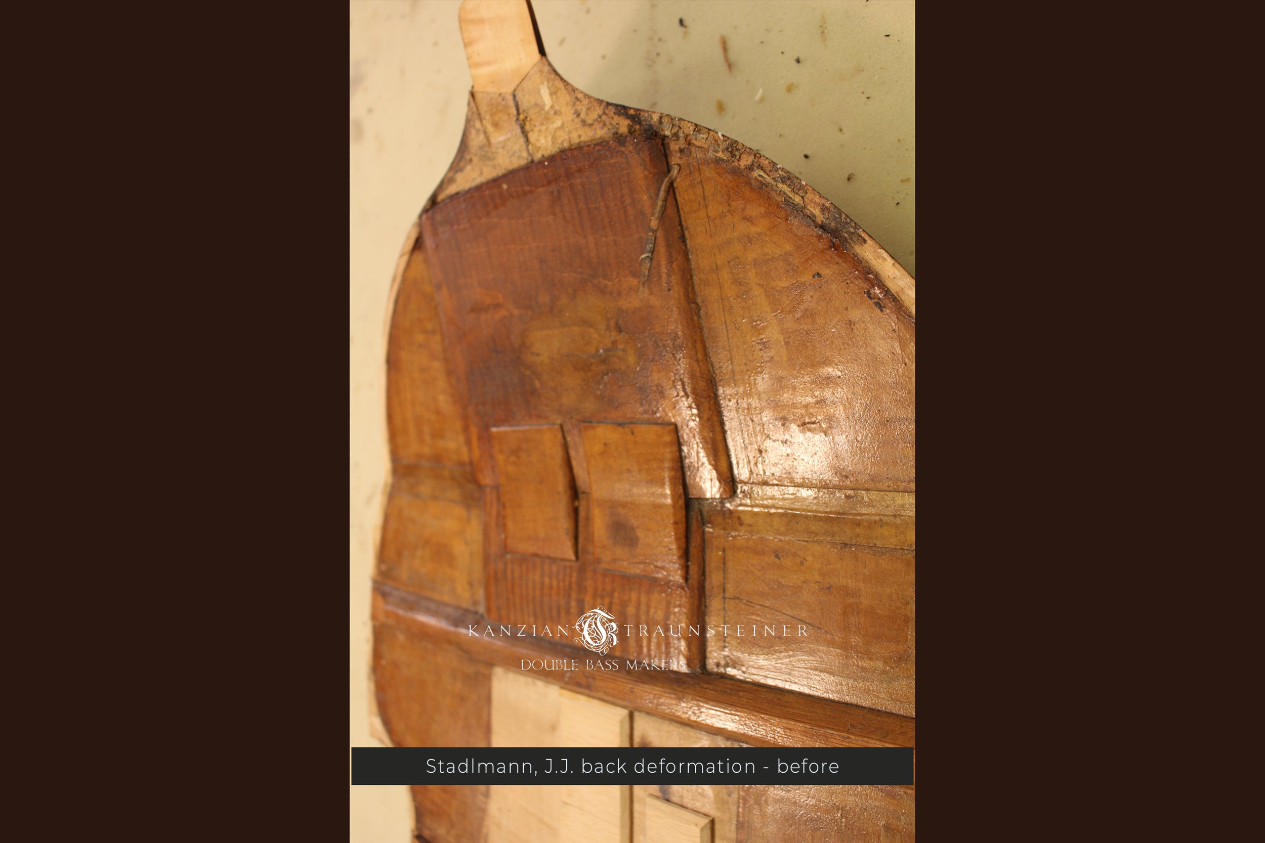 JJ Stadlman deformation before K&T restoration